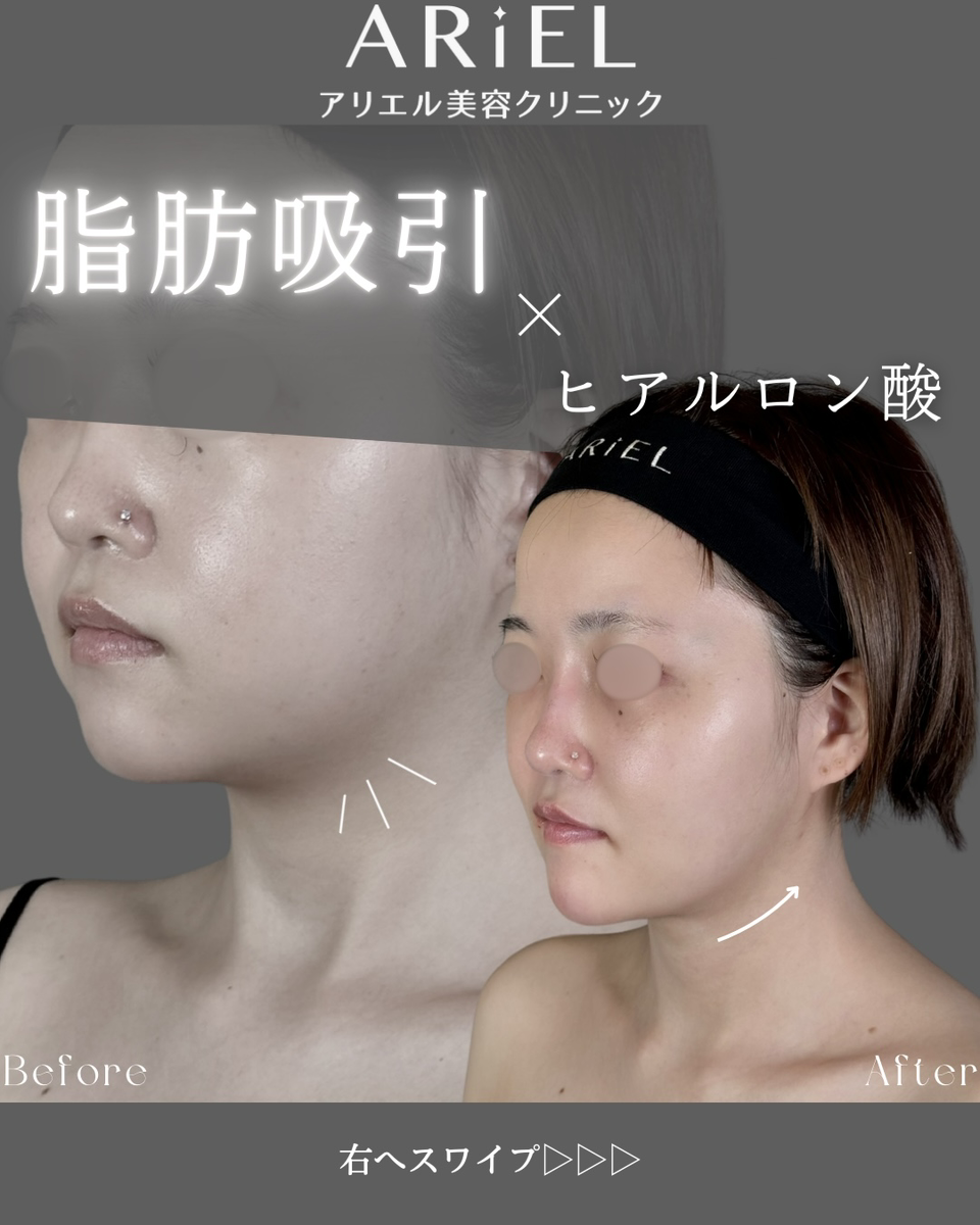 No.8682の症例写真